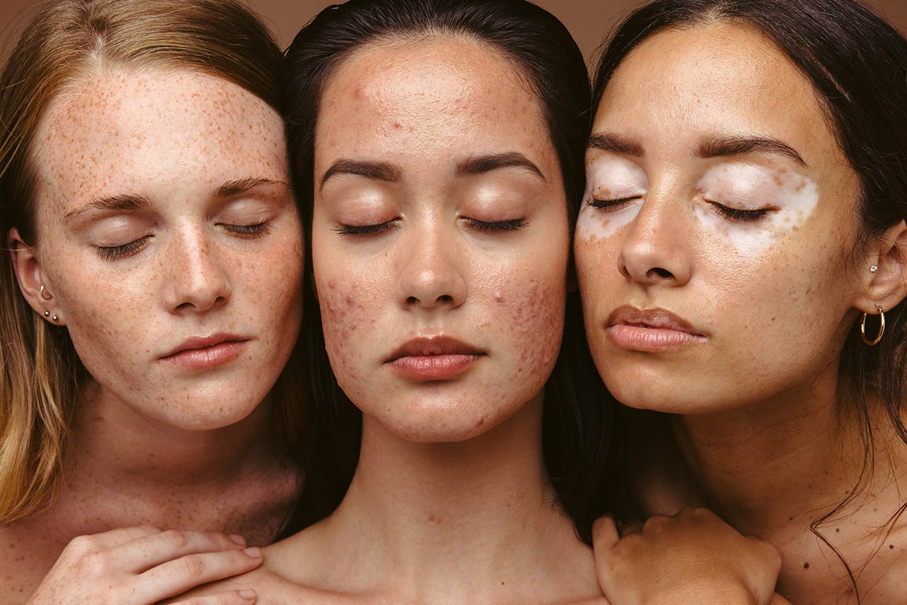 Mehr als Naturkosmetik: die anthroposophische Dermatologie